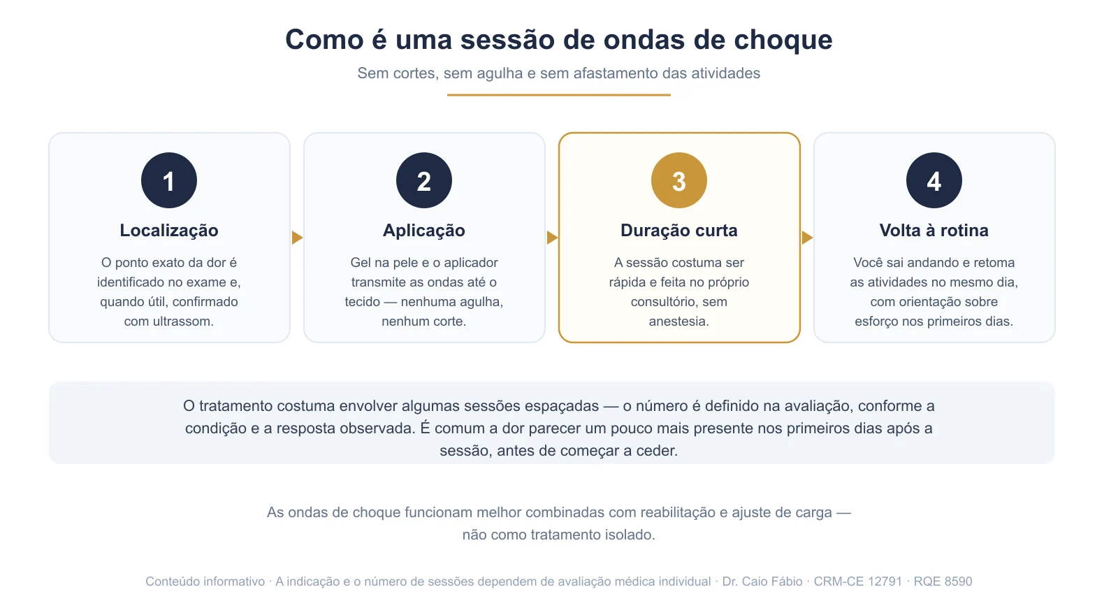 Infográfico com as quatro etapas de uma sessão de ondas de choque: localização do ponto, aplicação com gel, duração curta e retorno às atividades