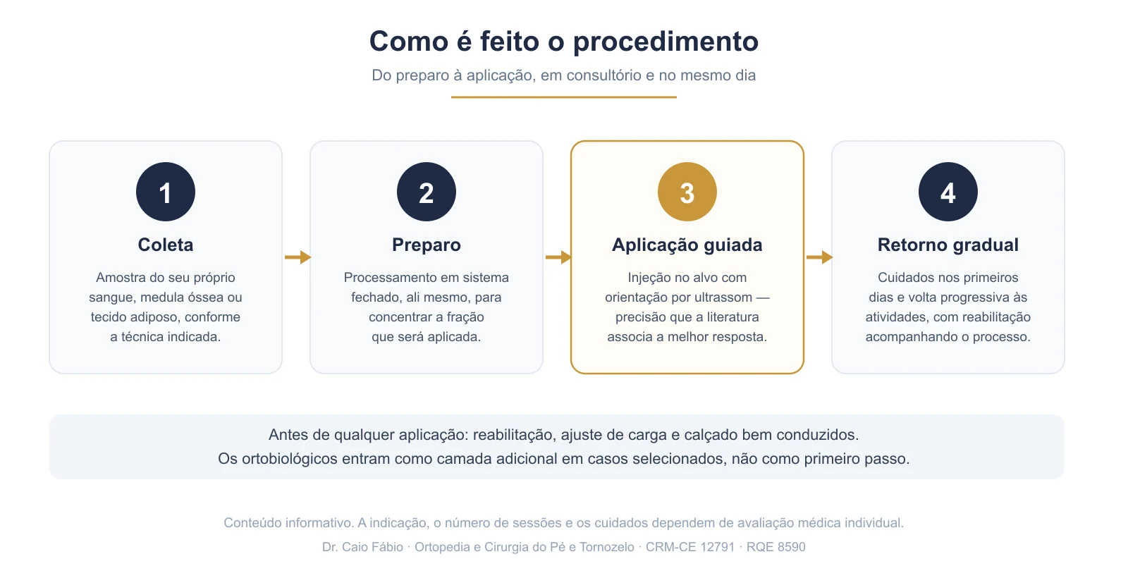 Infográfico com as quatro etapas do procedimento com ortobiológicos: coleta, preparo, aplicação guiada por ultrassom e retorno gradual às atividades
