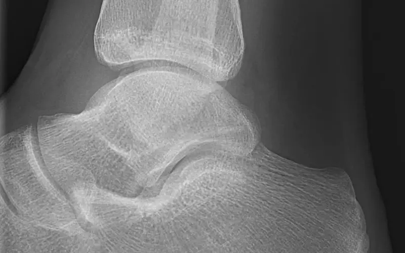 Radiografia de tornozelo em projeção lateral — imagem ilustrativa