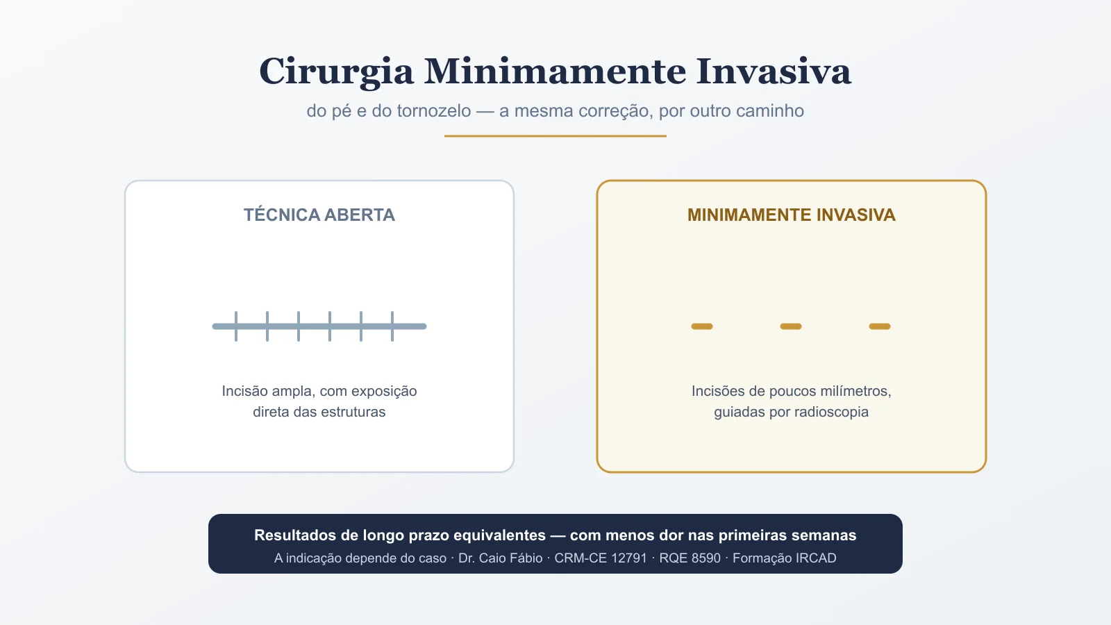 Instrumental cirúrgico delicado sobre campo estéril, referência a uma incisão de poucos milímetros em cirurgia percutânea do pé — imagem ilustrativa