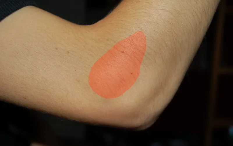 Cotovelo com a região do epicôndilo lateral destacada em vermelho, o ponto de dor da epicondilite — imagem ilustrativa