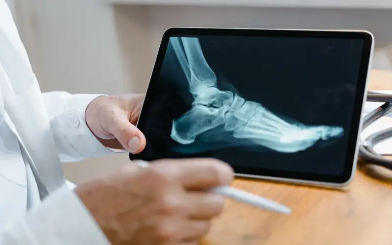 Médico apontando uma radiografia de pé em um tablet, avaliando os ossos do metatarso — imagem ilustrativa