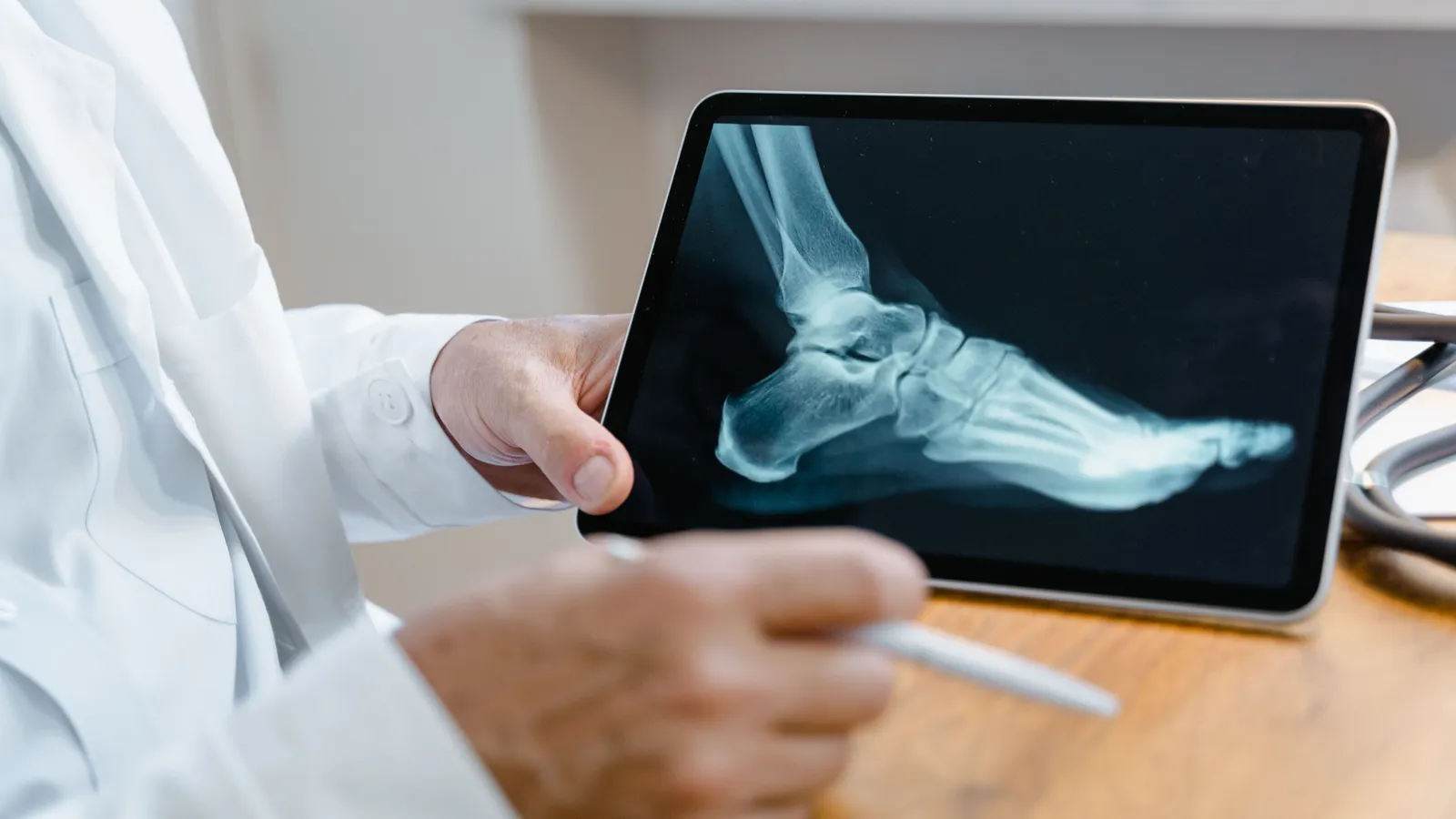 Médico apontando uma radiografia de pé em um tablet, avaliando os ossos do metatarso — imagem ilustrativa