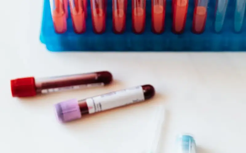 Material de laboratório usado no preparo de ortobiológicos — imagem ilustrativa